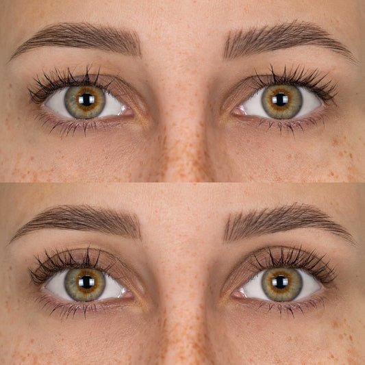 Patch lifting per palpebre